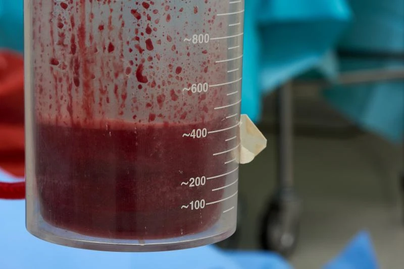Imagem ilustrativa de Frasco de vidro para aspiração 500ml